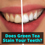 Does Green Tea Stain Your Teeth